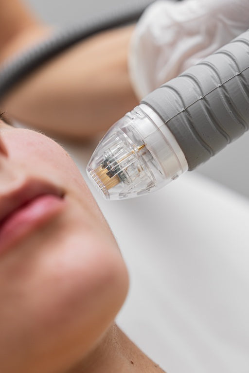 microneedling example