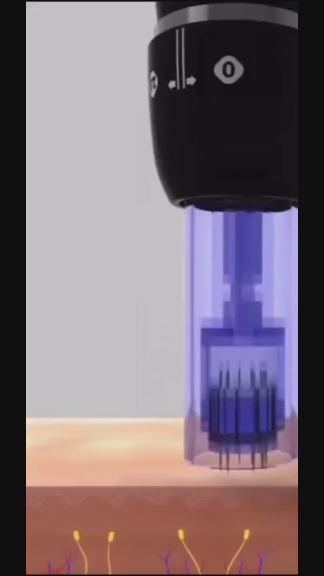 Charger la vidéo : &lt;p&gt;Les micro-canaux invisibles permettent ensuite une diffusion optimale de sérums hautement concentrés, formulés selon vos besoins spécifiques. Résultat : une absorption plus efficace et des actifs délivrés précisément là où votre peau en a besoin.&lt;/p&gt;